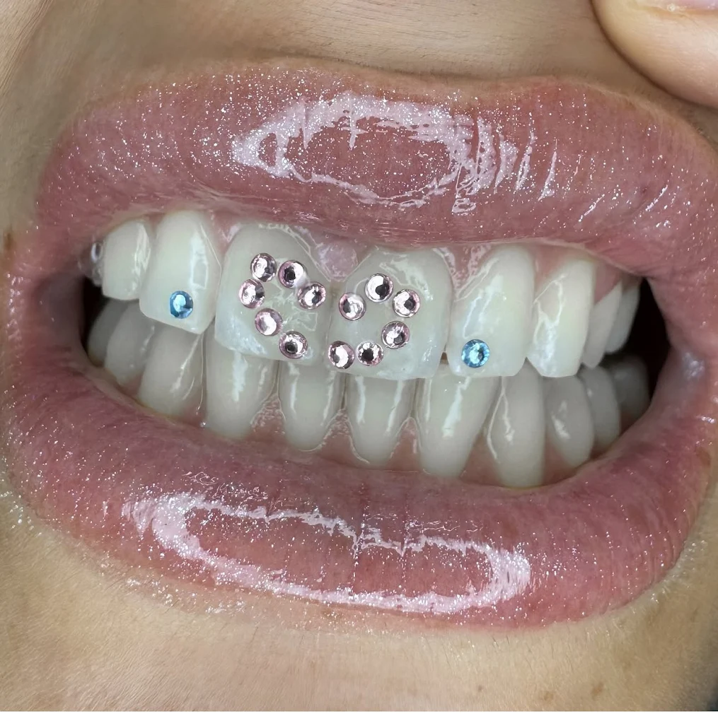 Gemas y strass dentales Swarovski diseño personalizado en Lily Gems Barcelona
