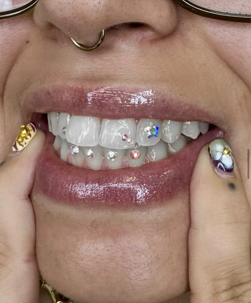Diseño de gemas dentales múltiples con cristales Swarovski multicolor