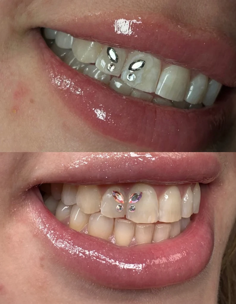 Diseño de strass dentales en forma de mariposa y marquesa