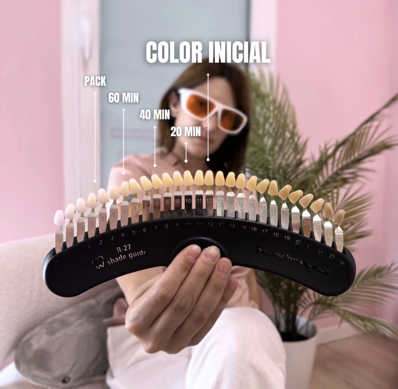 Proceso de blanqueamiento dental en Lily Gems — paleta de colores con tiempos de sesión